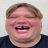 T1 NIXWARE FREE HVH